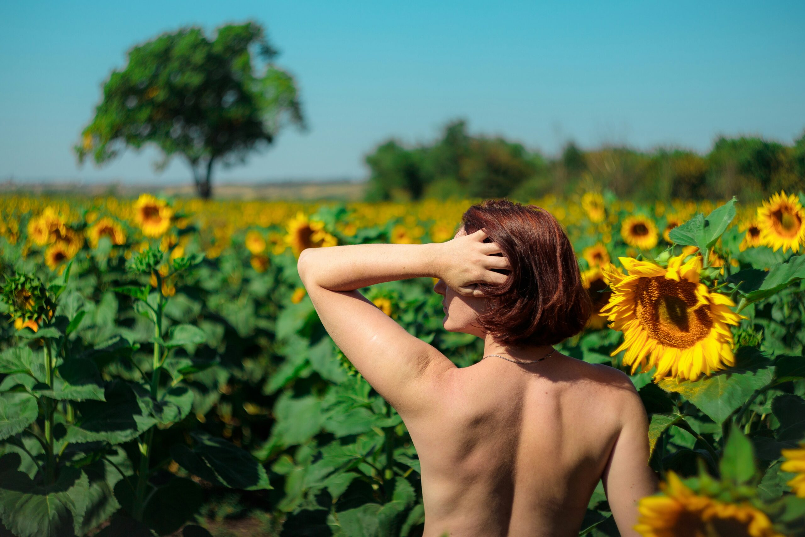 Why Does My Sunburn Itch So Bad? 9 Relief Tips That Help