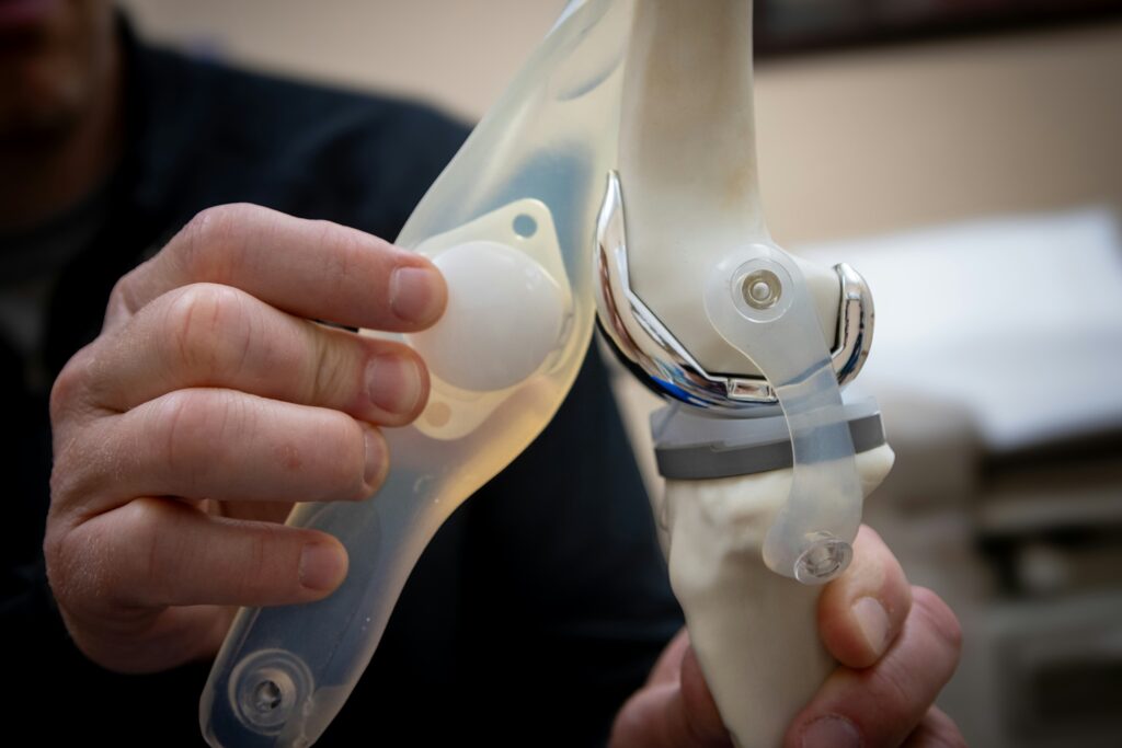 Why Is My Hip Replacement Hurting After 5 Years? Possible causes explained