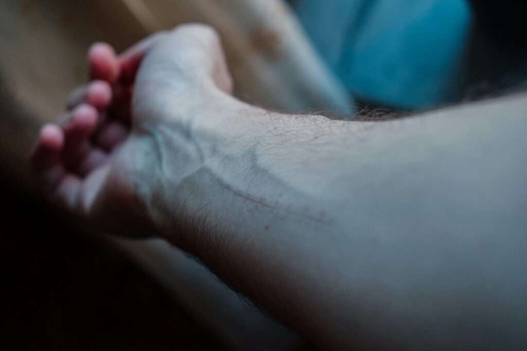 Why Do My Veins Pop Out? covering bulging veins, heat, exercise, weight changes, aging, circulation, and health warning signs.