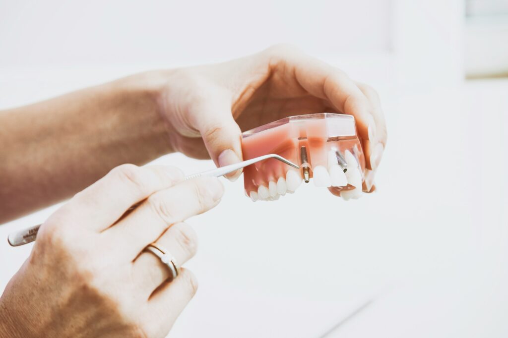 Why Are Dental Implants So Expensive? covering surgical costs, implant components, crowns, consultations, imaging, lab work, and insurance factors.