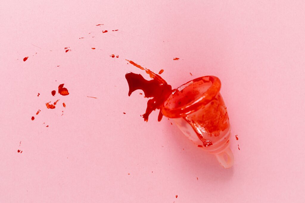 Why Am I Having Period Cramps but No Period? Causes and symptoms