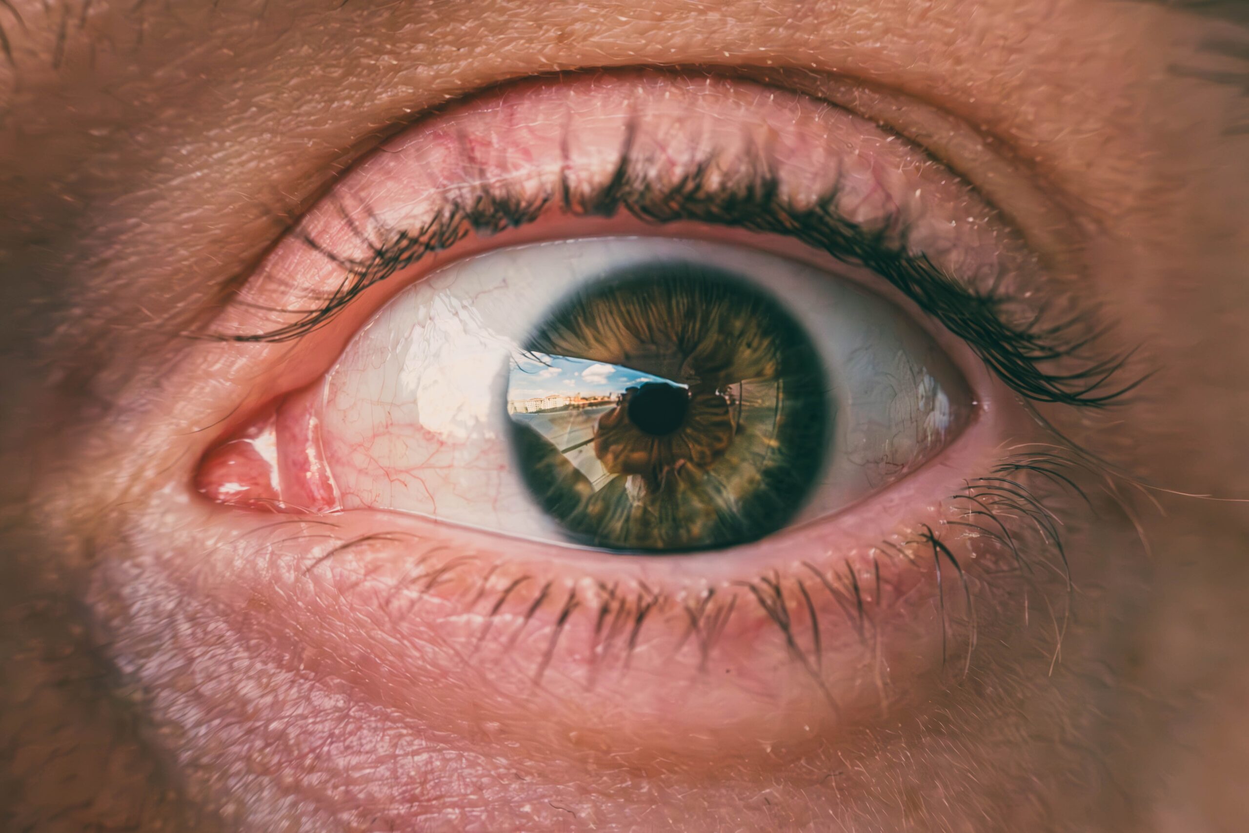 Why is my eye swollen when I wake up? Learn common causes of morning eye swelling and what to do.