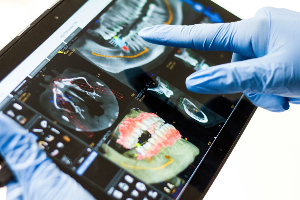Why Are Dental Implants So Expensive? guide to implant quality, surgery, bone procedures, crowns, laboratory fees, maintenance, and dental costs.