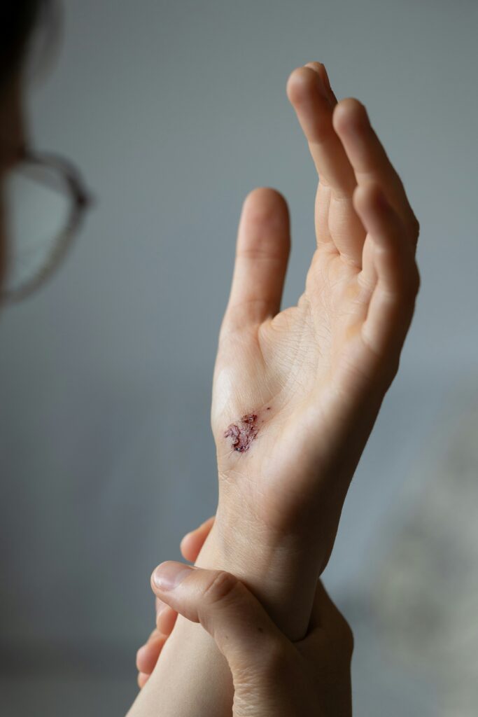Why Do Healing Wounds Itch? guide to new skin formation, nerve healing, dryness, inflammation, wound irritation, infection symptoms, and recovery.