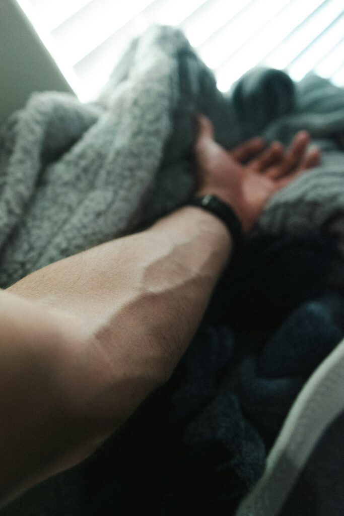 Why Do My Veins Pop Out? guide to visible veins, exercise, temperature, aging, genetics, circulation, vein health, and warning symptoms.