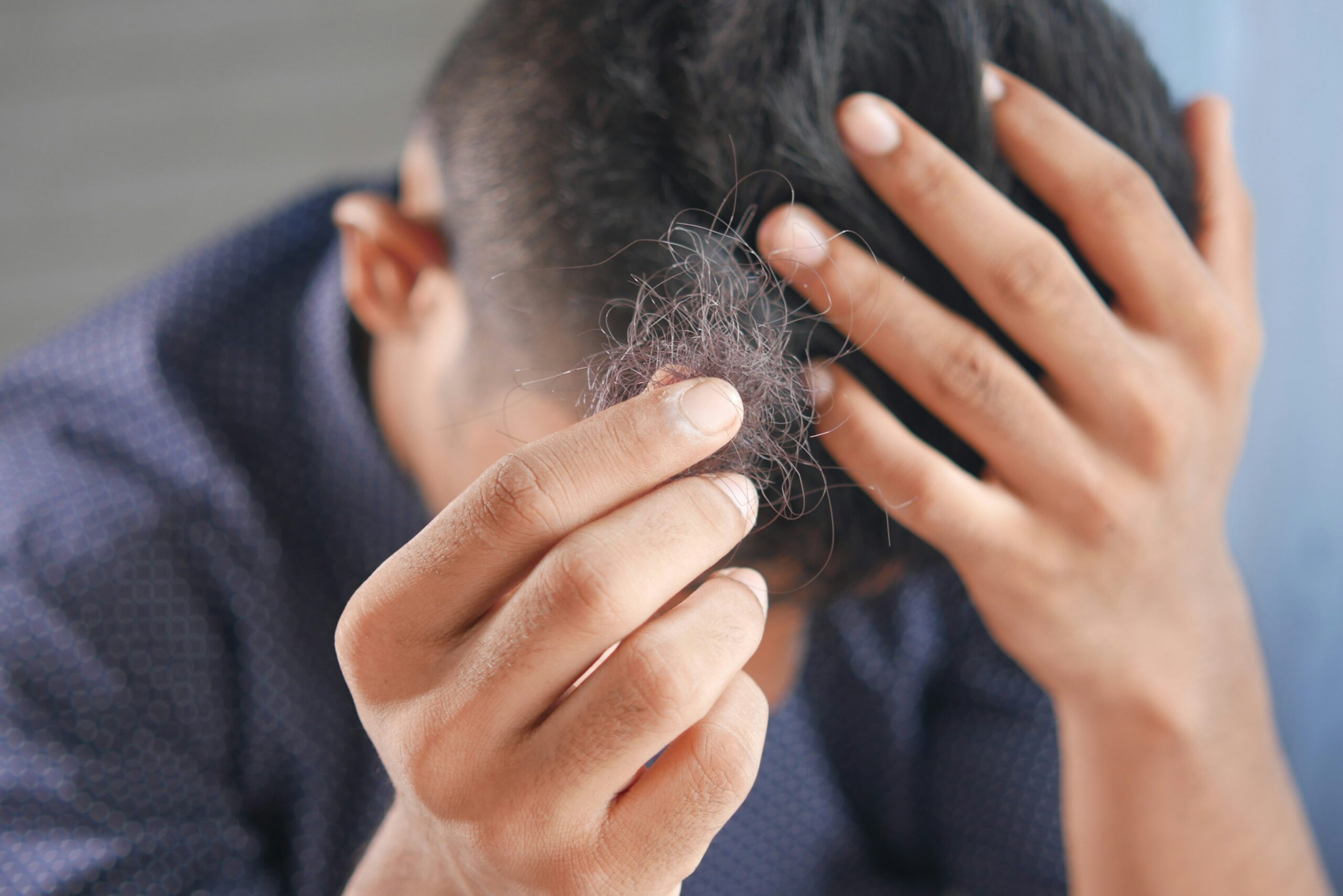 Why Do My Hair Follicles Hurt? 9 Surprising Causes You Should Know