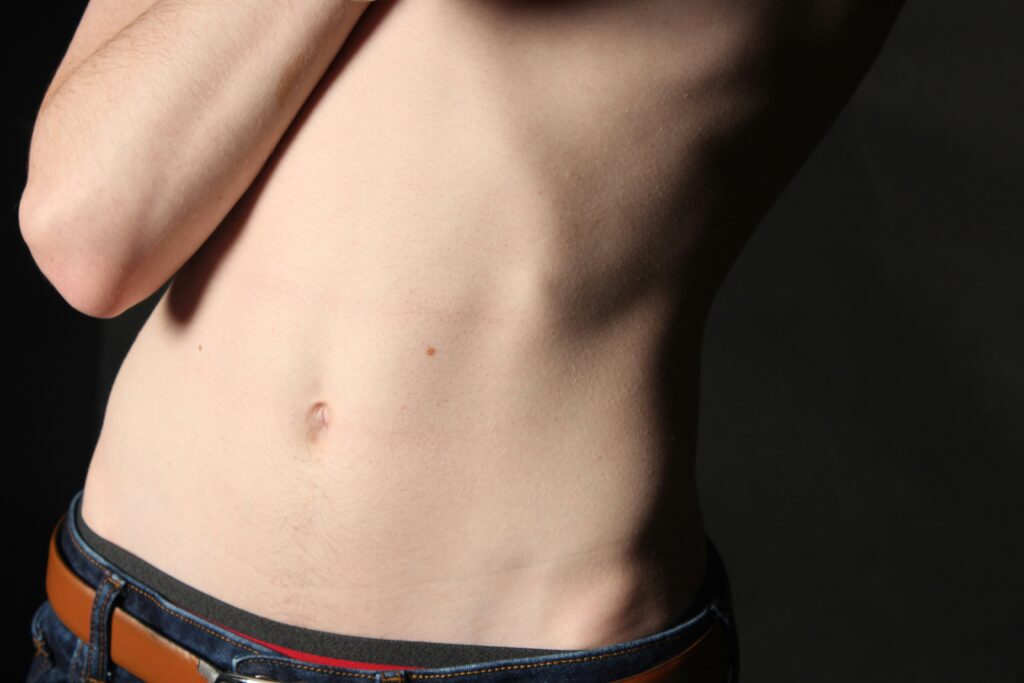 Why Does My C-Section Scar Hurt Years Later? covering nerve irritation, adhesions, scar sensitivity, endometriosis, inflammation, and persistent pain.